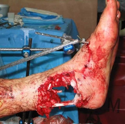 blessure d'un ours polaire pied